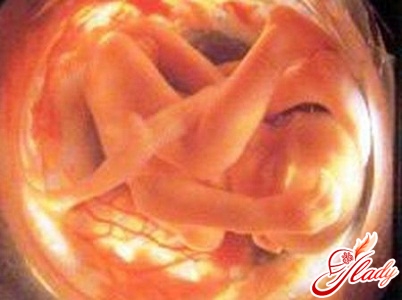 вагітність 29 тиждень ознаки симптоми узі