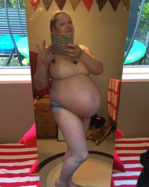 גוף של אישה לאחר הלידה