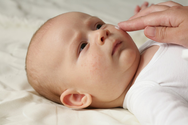 Symptome einer Allergie gegen die Mischung im Baby