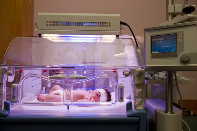 high bilirubin in the newborn