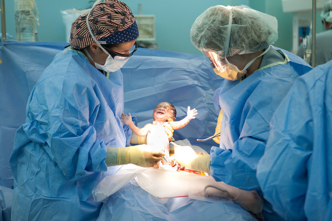 on what term do cesarean section
