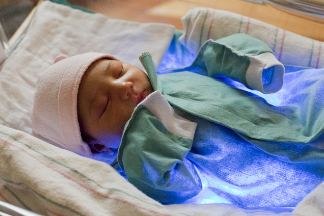 norm of bilirubin in newborns