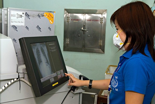 רנטגן של הריאות של הילד