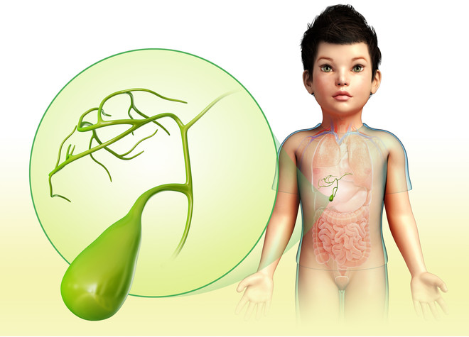 child's gallbladder bend symptoms