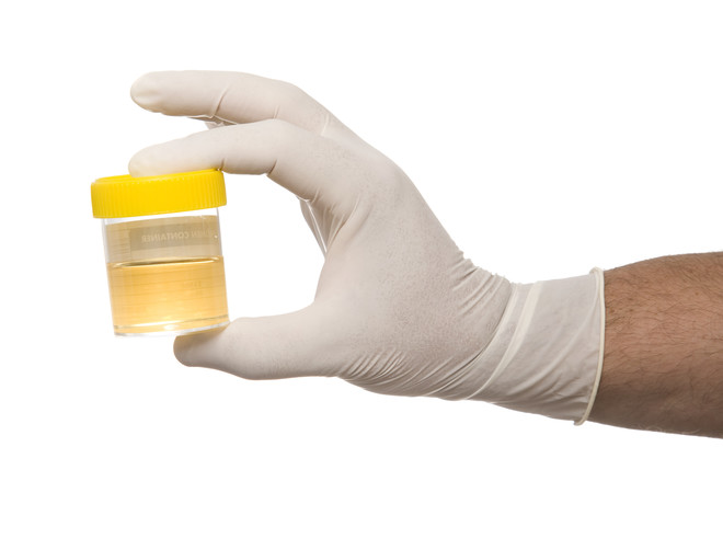 Does urine color change during pregnancy?