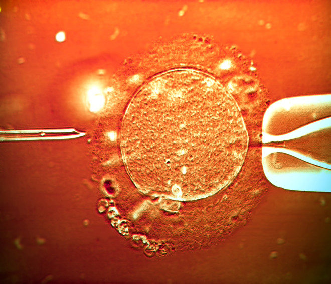 трансфер на ембриони
