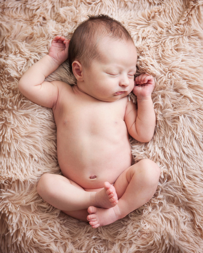 torticollis in newborns