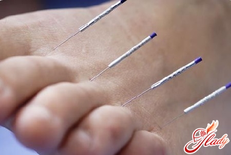 Acupuncture acupuncture points