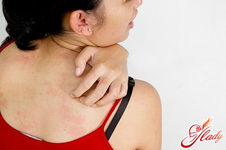 unpleasant allergy on the skin 