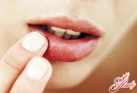 herpes treatment on the lips