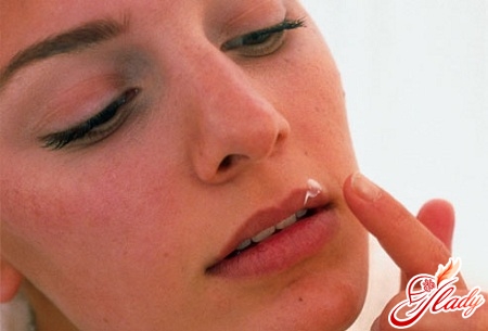 how quickly to cure herpes on the lip