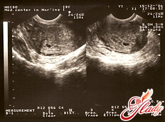 Schwangerschaft 3 Wochen Zeichen
