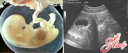 Schwangerschaft 7 Wochen uzi