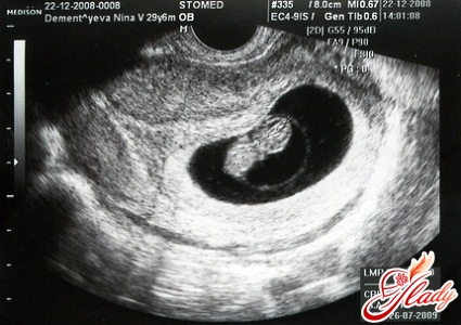 Schwangerschaft 9 Wochen - Uzi