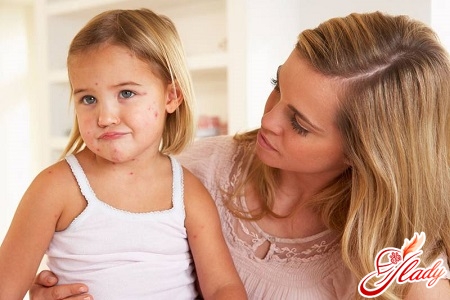 causes of rash in the child